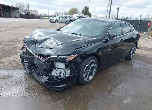 1G1ZD5ST9NF115337 2022 2022 Chevrolet Malibu- Fwd Lt 2