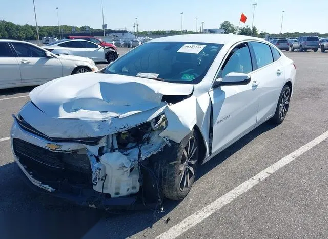 1G1ZD5ST1JF278221 2018 2018 Chevrolet Malibu- LT 2