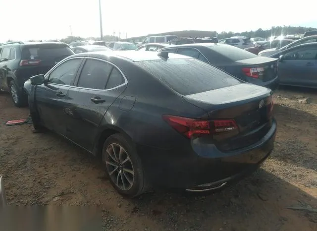 19UUB2F79FA018948 2015 2015 Acura TLX- V6 Advance 3