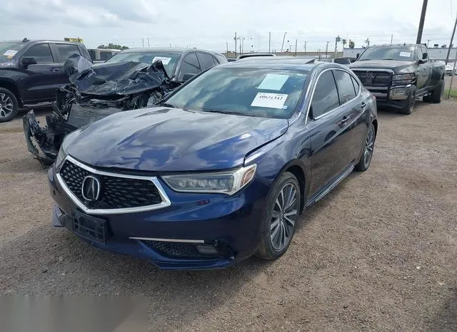 19UUB2F71JA003868 2018 2018 Acura TLX- Advance Pkg 2