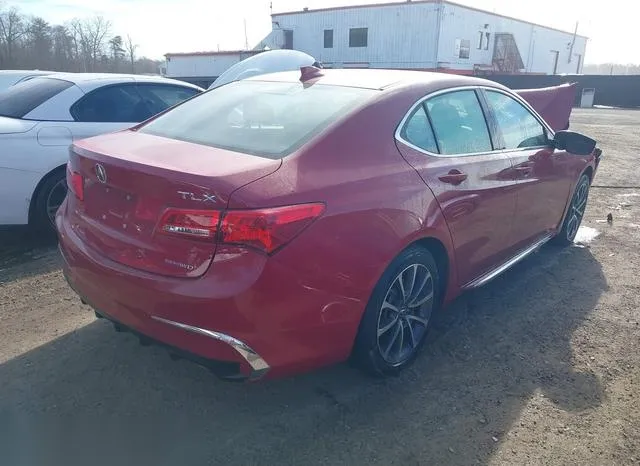 19UUB3F50JA002683 2018 2018 Acura TLX- Tech Pkg 4