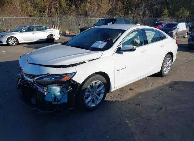 1G1ZG5ST2RF201909 2024 2024 Chevrolet Malibu- Fwd Rs 2