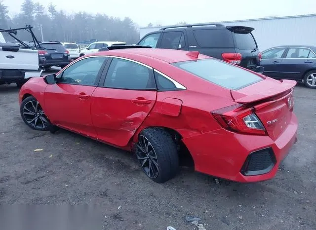 2HGFC1E57HH706256 2017 2017 Honda Civic- SI 3