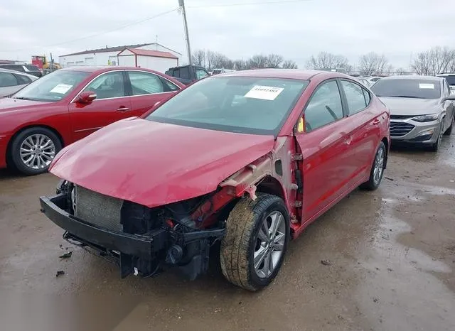 KMHD84LF3HU404539 2017 2017 Hyundai Elantra- SE 2