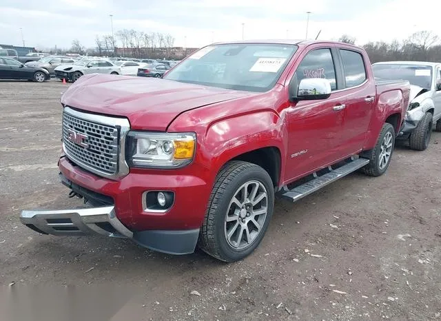 1GTG6EEN4J1317399 2018 2018 GMC Canyon- Denali 2