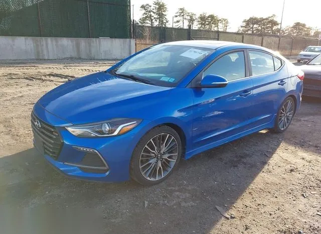 KMHD04LB9HU358493 2017 2017 Hyundai Elantra- Sport 2