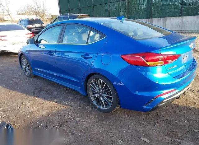 KMHD04LB9HU358493 2017 2017 Hyundai Elantra- Sport 3