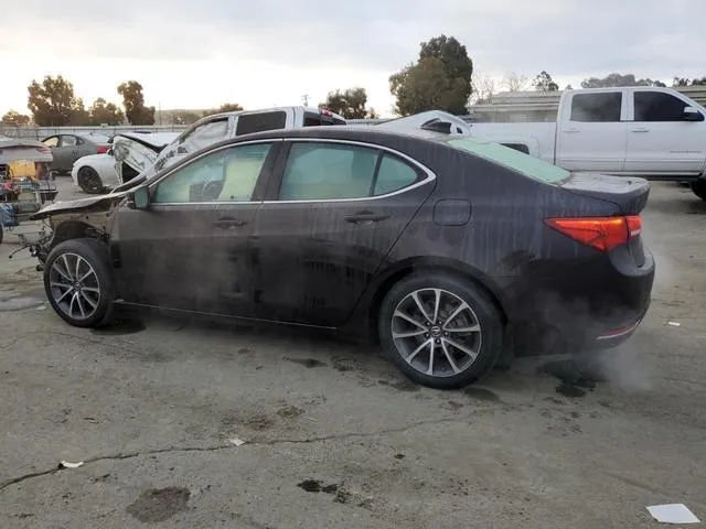 19UUB2F77FA007687 2015 2015 Acura TLX- Advance 2