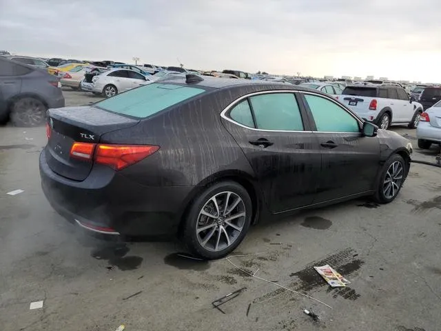 19UUB2F77FA007687 2015 2015 Acura TLX- Advance 3