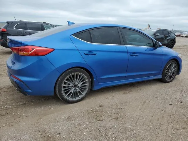 KMHD04LB4HU314580 2017 2017 Hyundai Elantra- Sport 3