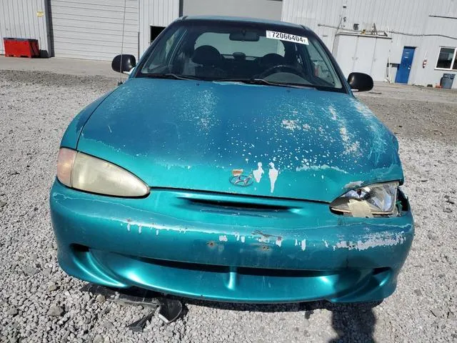 KMHVD14N1SU015961 1995 1995 Hyundai Accent- Base 5