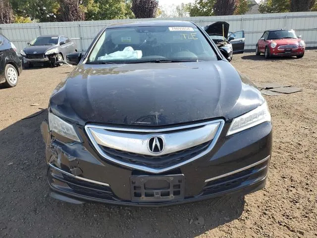 19UUB3F52FA001798 2015 2015 Acura TLX- Tech 5