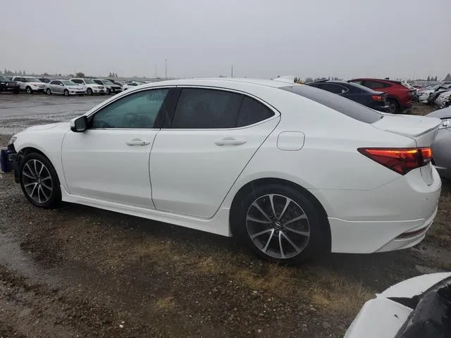 19UUB3F72FA001415 2015 2015 Acura TLX- Advance 2