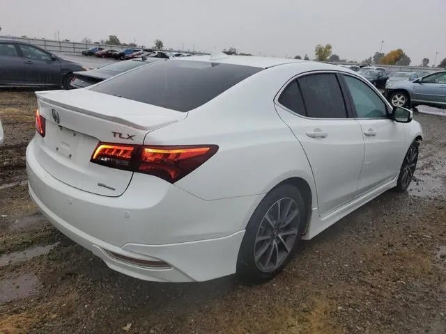 19UUB3F72FA001415 2015 2015 Acura TLX- Advance 3