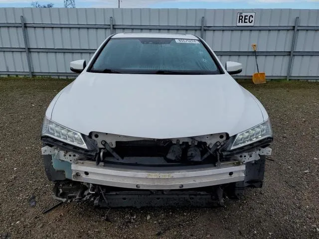 19UUB1F54FA015531 2015 2015 Acura TLX- Tech 5