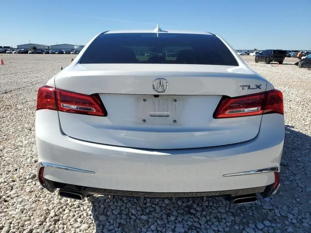 19UUB2F47LA001017 2020 2020 Acura TLX- Technology 6